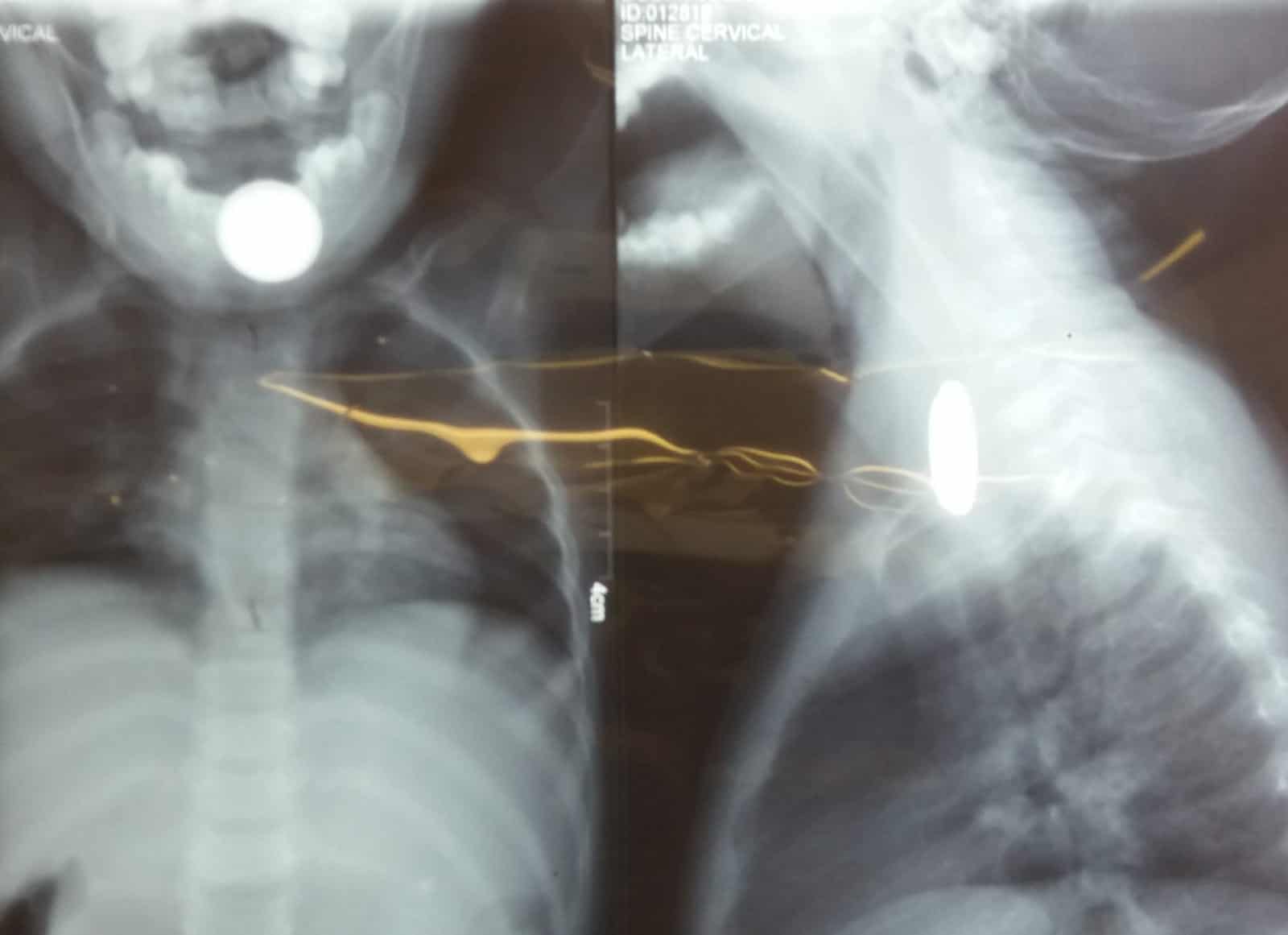 SIN DINERO NO HAY MEDICINA EN GRAN PARTE DEL MUNDO